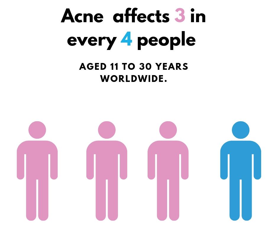 The figure shows the prevalence of acne worldwide.