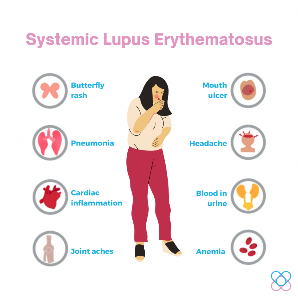 Systemic Lupus Erythematosus- Autoimmune Disorder