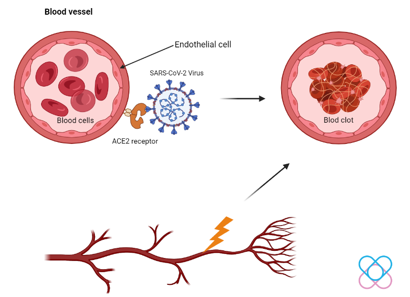 Mechanisms that may cause blood clot